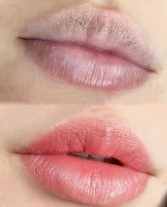 Semi-Permanent Lip — Before & After